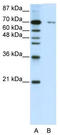 Zinc Finger Protein 398 antibody, TA345585, Origene, Western Blot image 