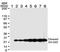 Rho GDP Dissociation Inhibitor Beta antibody, TA336465, Origene, Western Blot image 