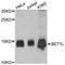 Bet1 Golgi Vesicular Membrane Trafficking Protein Like antibody, LS-C747199, Lifespan Biosciences, Western Blot image 