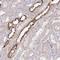 cN1A antibody, HPA050283, Atlas Antibodies, Immunohistochemistry paraffin image 