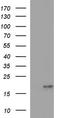 Phospholipase A And Acyltransferase 3 antibody, TA506912, Origene, Western Blot image 