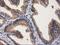 Glucosylceramidase Beta 3 (Gene/Pseudogene) antibody, NBP2-00521, Novus Biologicals, Immunohistochemistry frozen image 