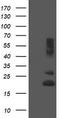 Protein TB2 antibody, TA505149, Origene, Western Blot image 