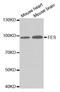 FES Proto-Oncogene, Tyrosine Kinase antibody, TA332564, Origene, Western Blot image 