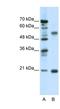Cholinergic Receptor Nicotinic Beta 3 Subunit antibody, NBP1-79950, Novus Biologicals, Western Blot image 