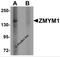Zinc Finger MYM-Type Containing 1 antibody, 6133, ProSci, Western Blot image 