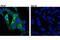6-Phosphofructo-2-Kinase/Fructose-2,6-Biphosphatase 2 antibody, 13029S, Cell Signaling Technology, Immunocytochemistry image 