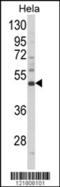Homeobox protein Nkx-2.3 antibody, LS-C164897, Lifespan Biosciences, Western Blot image 