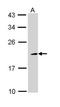 Nucleolysin TIA-1 isoform p40 antibody, GTX113280, GeneTex, Western Blot image 