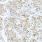 IL-17 antibody, 14-434, ProSci, Immunohistochemistry paraffin image 
