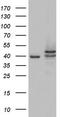 Casein Kinase 1 Epsilon antibody, TA803799, Origene, Western Blot image 