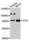 Vitronectin antibody, A10902, ABclonal Technology, Western Blot image 