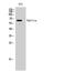 Raftlin antibody, GTX34158, GeneTex, Western Blot image 