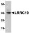 Leucine Rich Repeat Containing 19 antibody, orb94367, Biorbyt, Western Blot image 