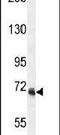 VPS52 Subunit Of GARP Complex antibody, PA5-24408, Invitrogen Antibodies, Western Blot image 