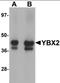 Y-Box Binding Protein 2 antibody, orb94571, Biorbyt, Western Blot image 