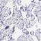 Interferon regulatory factor 4 antibody, HPA002698, Atlas Antibodies, Immunohistochemistry paraffin image 