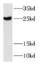 RAB39A, Member RAS Oncogene Family antibody, FNab07022, FineTest, Western Blot image 