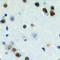 Zinc Finger CCCH-Type Containing 7B antibody, LS-C368848, Lifespan Biosciences, Immunohistochemistry paraffin image 