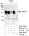 Catenin Delta 1 antibody, A300-977A, Bethyl Labs, Immunoprecipitation image 