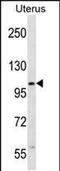 Zinc Finger SWIM-Type Containing 5 antibody, PA5-48589, Invitrogen Antibodies, Western Blot image 