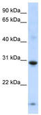Zinc Finger Protein 138 antibody, TA342440, Origene, Western Blot image 