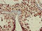 Ribosomal Protein L23a antibody, CSB-PA020187LA01HU, Cusabio, Immunohistochemistry frozen image 