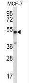 Ghrelin O-acyltransferase antibody, LS-C164064, Lifespan Biosciences, Western Blot image 