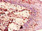 Ectonucleoside Triphosphate Diphosphohydrolase 8 antibody, CSB-PA007697LA01HU, Cusabio, Immunohistochemistry paraffin image 