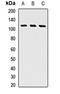 Gamma-Glutamyl Carboxylase antibody, orb412029, Biorbyt, Western Blot image 