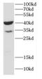 Calcium Activated Nucleotidase 1 antibody, FNab01245, FineTest, Western Blot image 