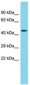 Armadillo Repeat Containing 6 antibody, TA333581, Origene, Western Blot image 