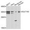 Sulfotransferase 1A3/1A4 antibody, STJ110241, St John
