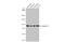CycT1 antibody, GTX133413, GeneTex, Western Blot image 