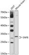 SNF8 Subunit Of ESCRT-II antibody, 13-737, ProSci, Western Blot image 