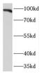 Kinesin Associated Protein 3 antibody, FNab04571, FineTest, Western Blot image 