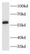 Karyopherin Subunit Alpha 5 antibody, FNab04637, FineTest, Western Blot image 