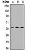 Major Histocompatibility Complex, Class II, DQ Beta 1 antibody, orb234873, Biorbyt, Western Blot image 