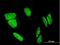 FLJ23834 antibody, H00222256-M03, Novus Biologicals, Immunocytochemistry image 
