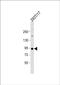 Hepatocyte growth factor-like protein antibody, PA5-71683, Invitrogen Antibodies, Western Blot image 