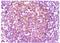 CD14 antibody, AM06089PU-N, Origene, Immunohistochemistry paraffin image 