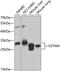 Glutathione S-transferase Mu 4 antibody, GTX32637, GeneTex, Western Blot image 