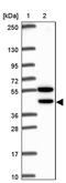 Cyclin Dependent Kinase Like 1 antibody, PA5-63754, Invitrogen Antibodies, Western Blot image 