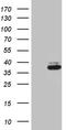 Dscr1 antibody, TA810470S, Origene, Western Blot image 