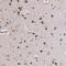 Melanoma-associated antigen E1 antibody, PA5-51808, Invitrogen Antibodies, Immunohistochemistry frozen image 