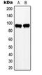 Zinc fingers and homeoboxes protein 2 antibody, orb224079, Biorbyt, Western Blot image 