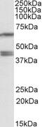 Vacuolar fusion protein MON1 homolog A antibody, 42-515, ProSci, Western Blot image 
