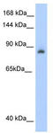 IRP1 antibody, TA345794, Origene, Western Blot image 