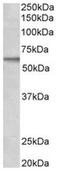 Activin A Receptor Like Type 1 antibody, AP31557PU-N, Origene, Western Blot image 
