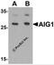 Androgen Induced 1 antibody, 6785, ProSci, Western Blot image 